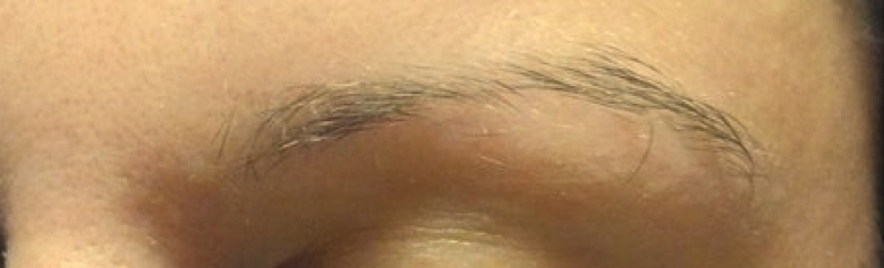 content image
